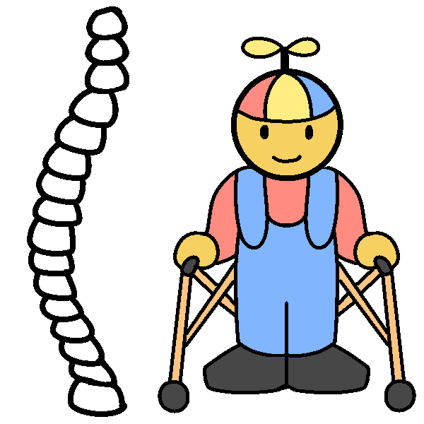 A curving spine next to a child in overalls and a propeller hat, using an anterior walker.